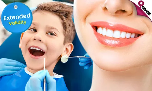 Teeth Cleaning, Polishing & Fluoride Application for Kids & Adults!
